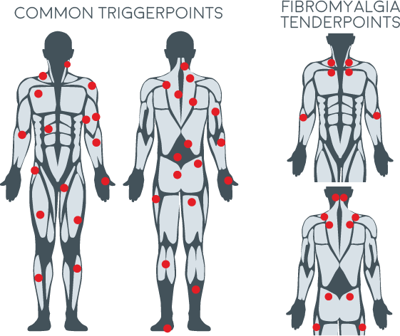 Core Trigger Point Products – Core Balance Movement
